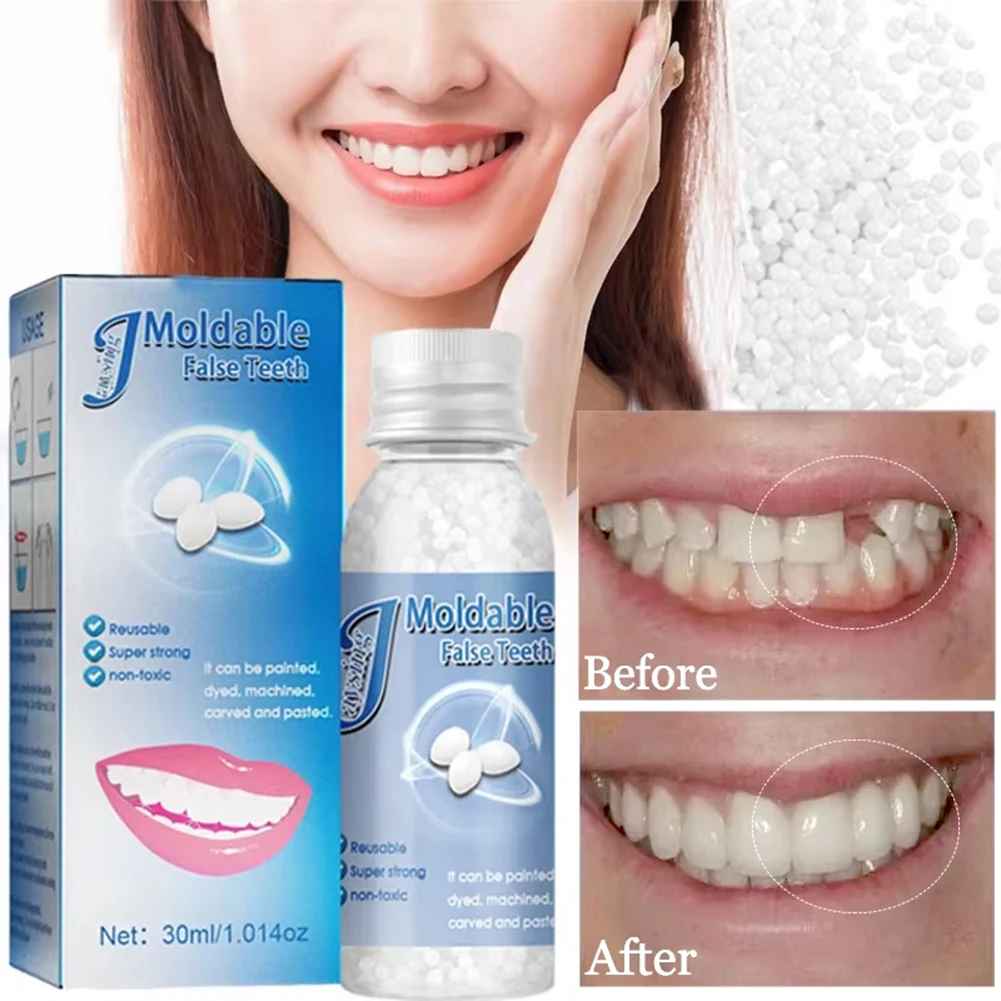 TeethRepair™ 1+1 GRATIS: kit per la riparazione dei denti dall'aspetto naturale
