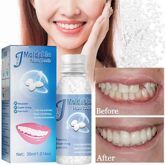 TeethRepair™ 1+1 GRATIS: kit per la riparazione dei denti dall'aspetto naturale