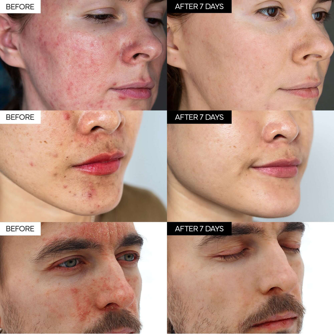 Intensive Cica Repair Cream