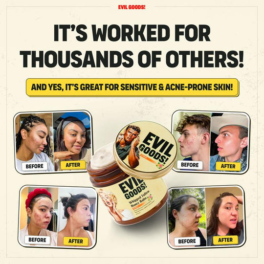 EVIL GOODS! Whipped Beef Tallow & Manuka Honey Organic Nourishing Face Cream Moisturizer Body Lotion Skin Care Lip Balm Hydrating Moisturizing 100% Natural Ingredients - Oil