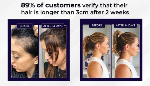 🖤Promoție de Black Friday: 40% reducere🖤 Spray HZA™ pentru regenerarea părului natural