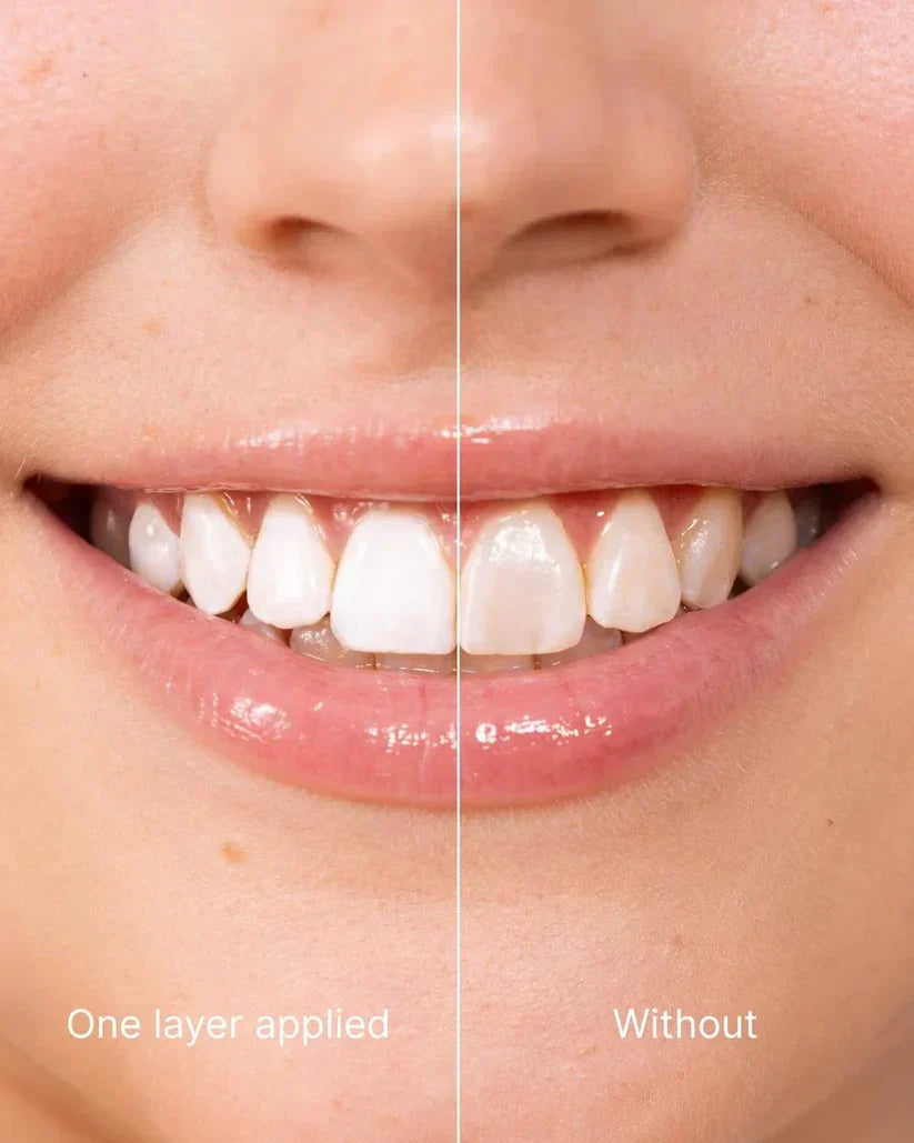 Tooth Polish - Instant Clean Smile