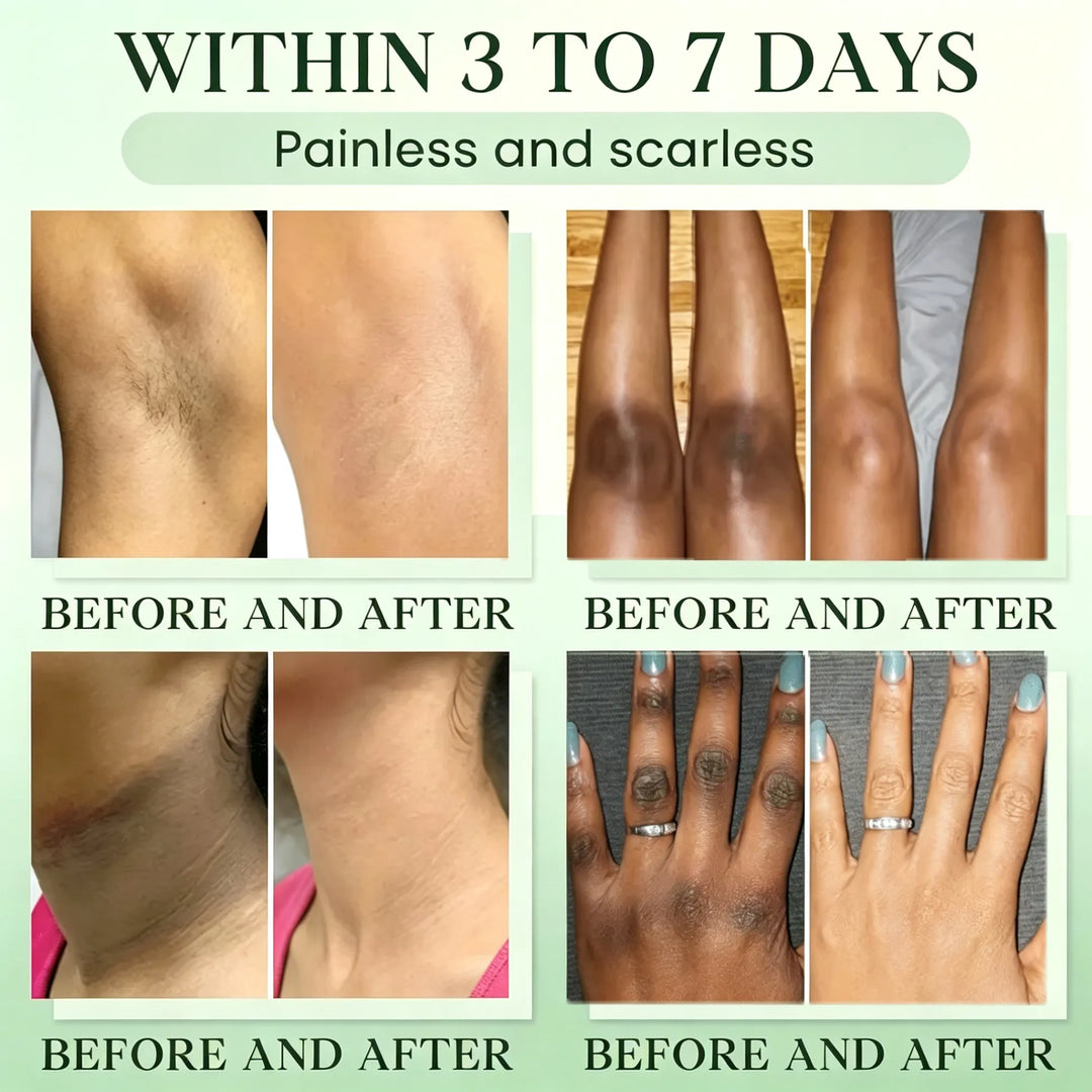 Green Tea Triple Enzyme Peeling Gel for Dark & Intimate Areas