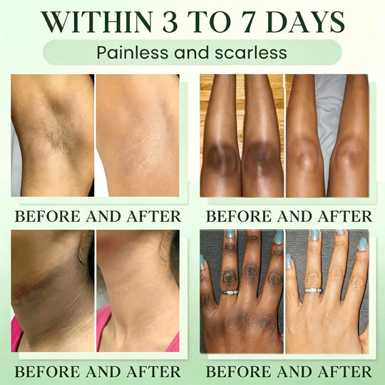 Green Tea Triple Enzyme Peeling Gel for Dark & Intimate Areas