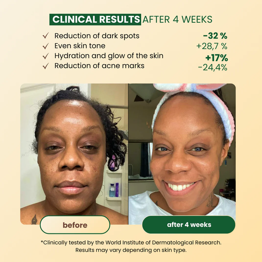 CuraGlow Anti-Spots & Hyperpigmentation Soap