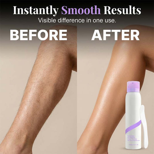 KLENIMORE ™  Gentle & Painless Hair Removal Cream Duo for Sensitive Skin