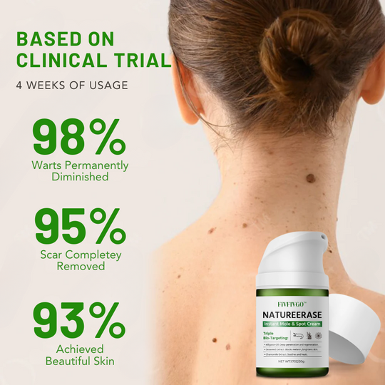 ✅ Boutique officielle : Fivfivgo™ NatureErase Instant Mole & Crème anti-taches
