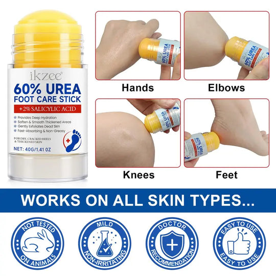 40g Urea Foot Care Stick, Moisturizing Hydrating Foot Care Cream, Intensive Repair Foot Skin Care Product for Dry Cracked Heels, Foot Dead Skin Remover