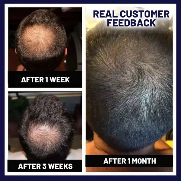 🖤Promoție de Black Friday: 40% reducere🖤 Spray HZA™ pentru regenerarea părului natural