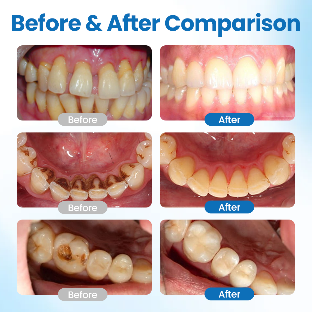 NanoHAP Tooth Defense Serum