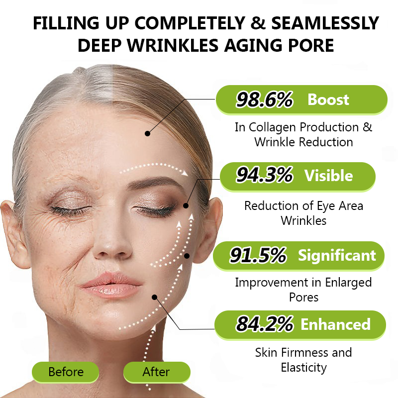 🖤Kara Cuma İndirimi: %40 İNDİRİM🖤**Sanatçının Annesi**👍| Genç cildinize kavuşun 💫STDEI® BOTOKS & VITA A RETINOL SHOT Kırışıklık Giderici Sıkılaştırıcı Krem