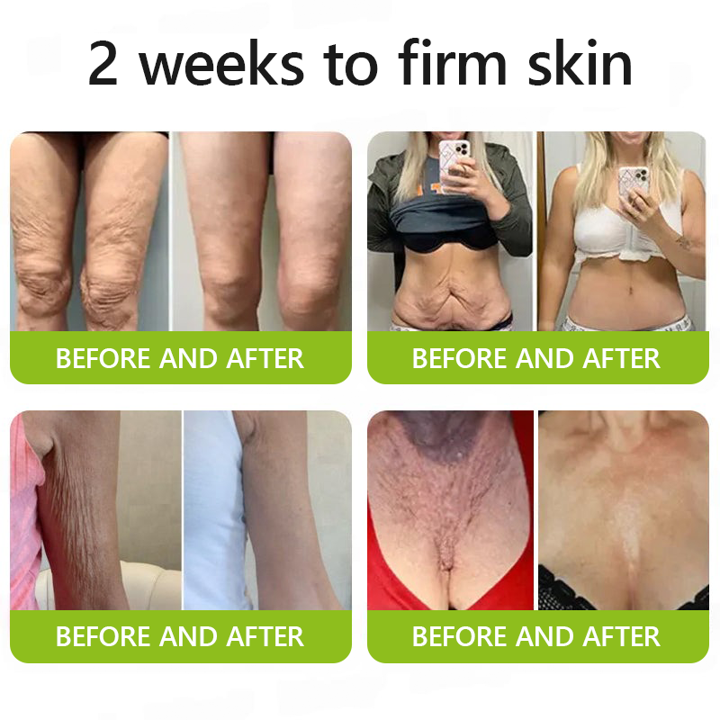 𝑶𝒇𝒇𝒊𝒄𝒊𝒂𝒍 𝑺𝒕𝒐𝒓𝒆👍| Nyerje vissza fiatalos bőrét most 💫STDEI® BOTOX &amp; VITA A RETINOL SHOT Ránctalanító Feszesítő Krém