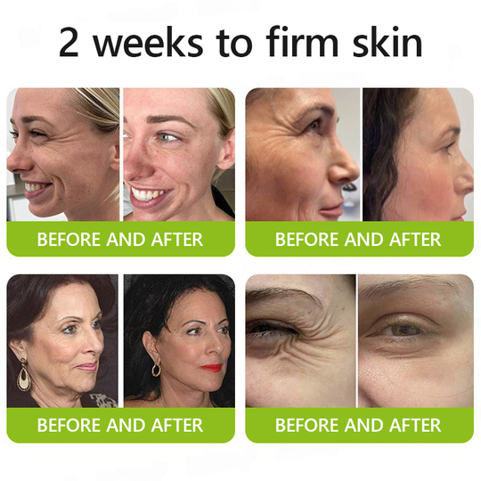 🖤Kara Cuma İndirimi: %40 İNDİRİM🖤**Sanatçının Annesi**👍| Genç cildinize kavuşun 💫STDEI® BOTOKS & VITA A RETINOL SHOT Kırışıklık Giderici Sıkılaştırıcı Krem