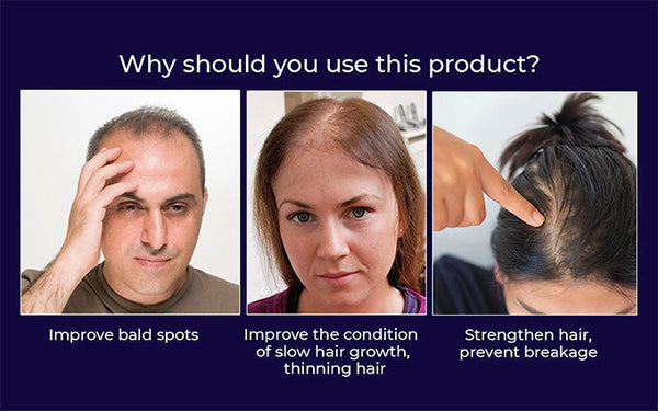 🖤Promoție de Black Friday: 40% reducere🖤 Spray HZA™ pentru regenerarea părului natural