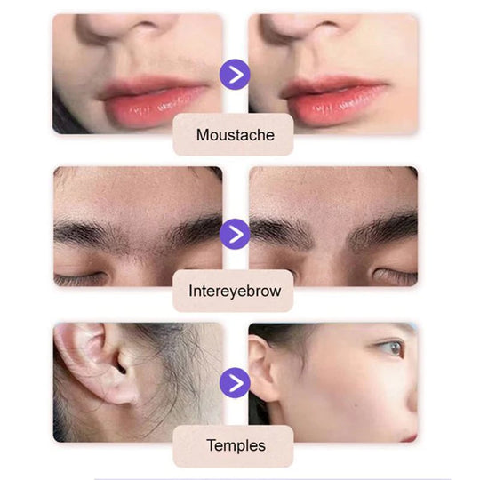 ❤️Finally!  Facial Hair Freedom: Gentle and Painless Facial Hair Removal Cream