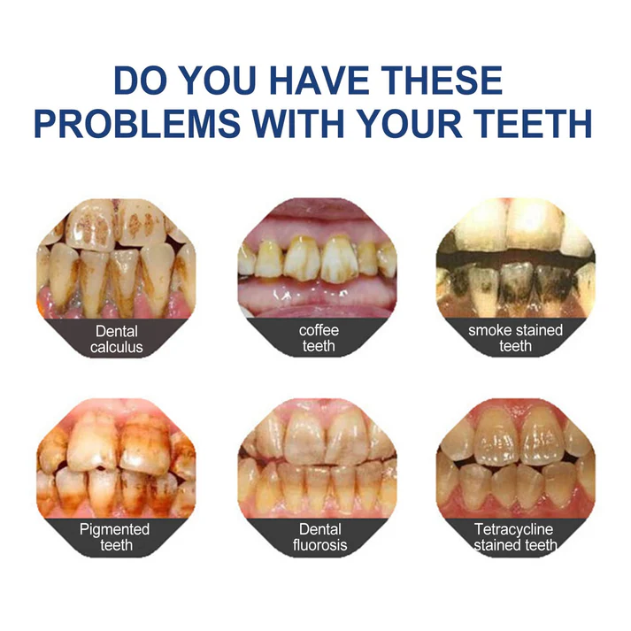 🔥Končí dnes večer: Získejte 40% slevu, než bude pryč!🎁 YaGoo™ zubní pasta s hydroxyapatitem bez fluoridu – šetrné bělení & Síla skloviny pro citlivé zuby