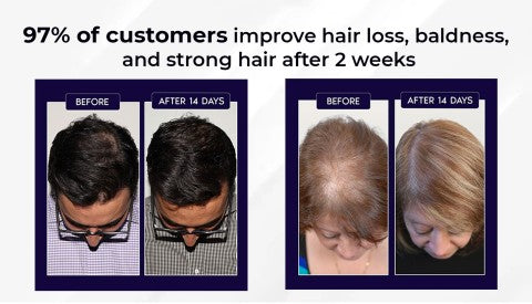 🖤Promoție de Black Friday: 40% reducere🖤 Spray HZA™ pentru regenerarea părului natural