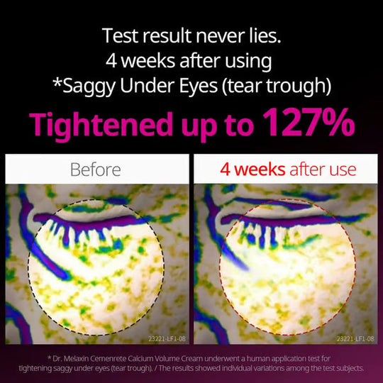 🔥Sconto di Natale 49% di sconto🎄Crema riparatrice concentrata al calcio