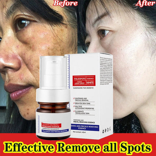 ⚡Iluminare în 5 secunde! Vitamina C, ESENȚĂ pentru albirea pistruilor