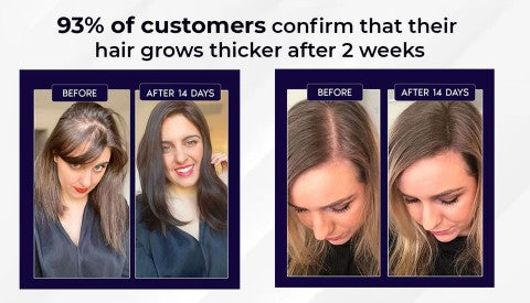 🖤Promoție de Black Friday: 40% reducere🖤 Spray HZA™ pentru regenerarea părului natural