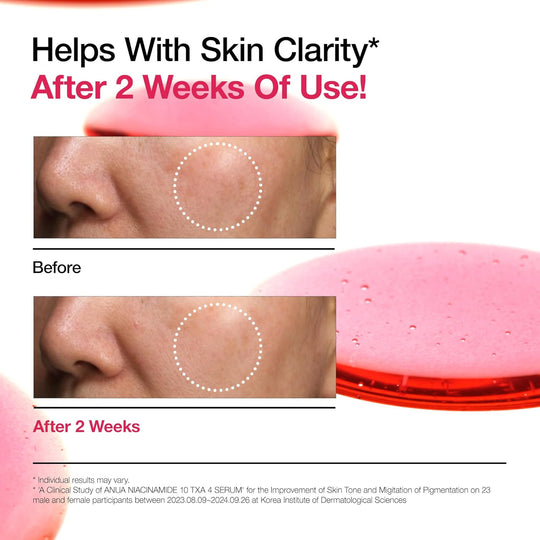 ANUA NIACINAMIDE 10% + TXA 4% SÖTÉT FOLTOK KORREKCIÓS SZÉRUM (30 ml)