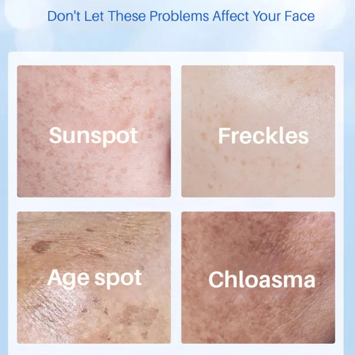 La leche con esencia para manchas de la edad mejora la pigmentación de la piel Crema con esencia Yello para reducir las manchas de la edad