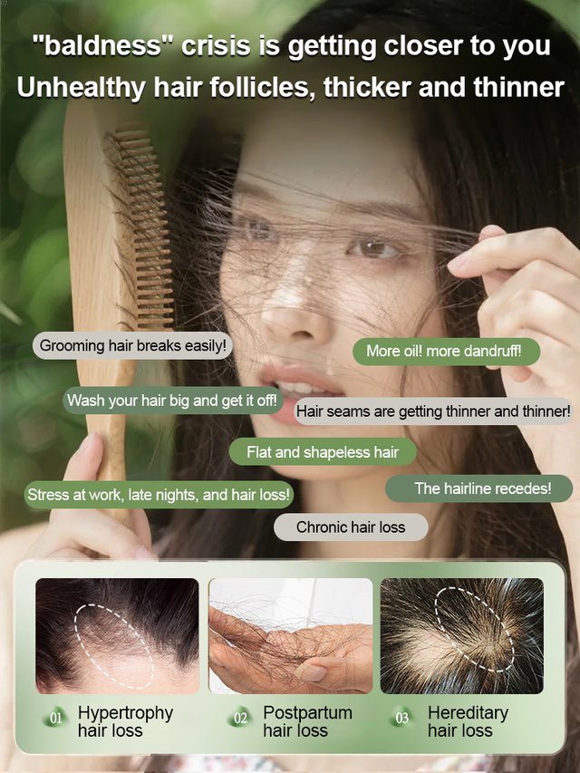 🖤Снижење за Црни петак: 40% попуста🖤【Против губитка косе и против раста косе】Усман биљни сапун за јачање косе са ориенталским цепарином