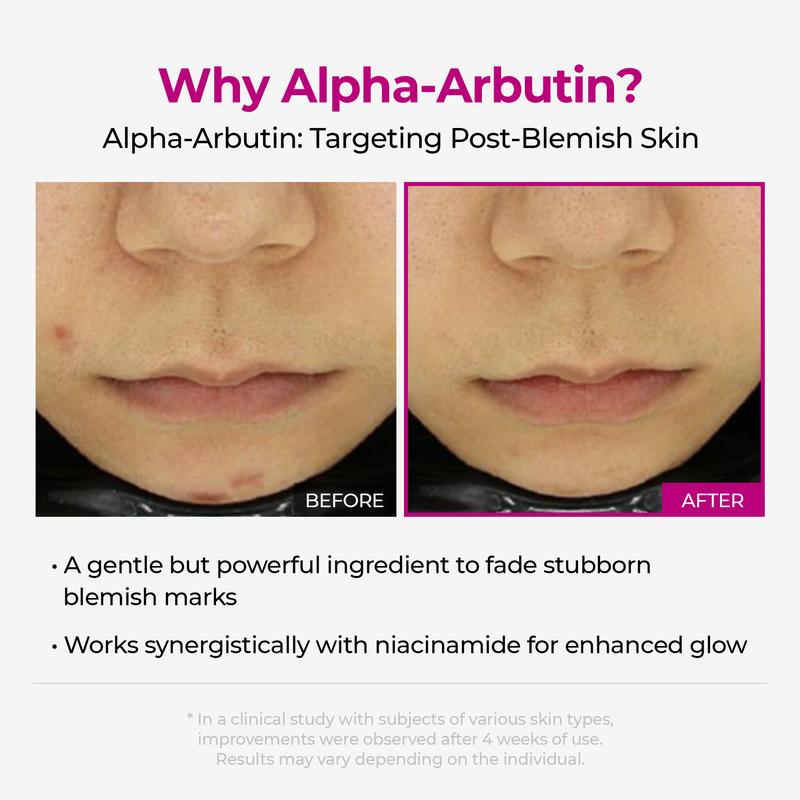 [Dr.Melaxin Službena trgovina]Lumi Pore & Spot Care Duo | Smanjuje pore & Fades Blemish Marks | Cyano Pink Spicule Serum + Picotonic Shot ampula