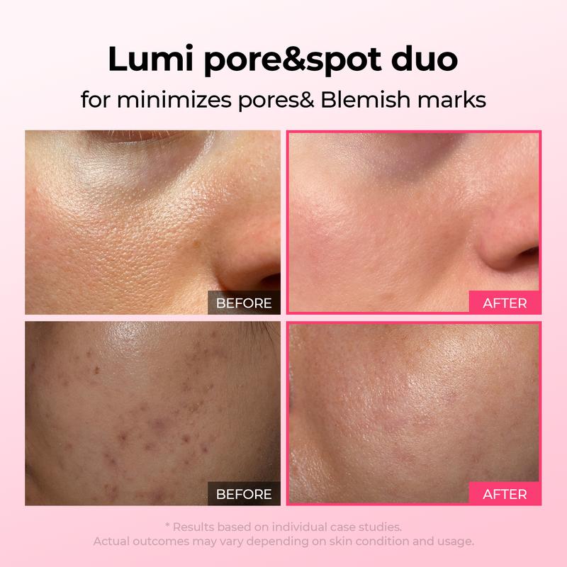 [Dr.Melaxin Službena trgovina]Lumi Pore & Spot Care Duo | Smanjuje pore & Fades Blemish Marks | Cyano Pink Spicule Serum + Picotonic Shot ampula