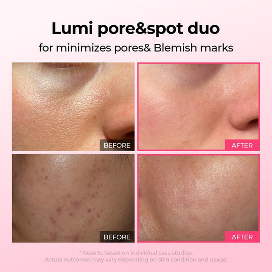 [Dr.Melaxin Službena trgovina]Lumi Pore & Spot Care Duo | Smanjuje pore & Fades Blemish Marks | Cyano Pink Spicule Serum + Picotonic Shot ampula