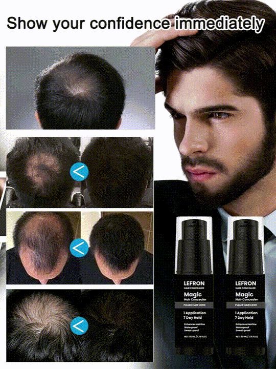 HOEGOA Hair Concealer