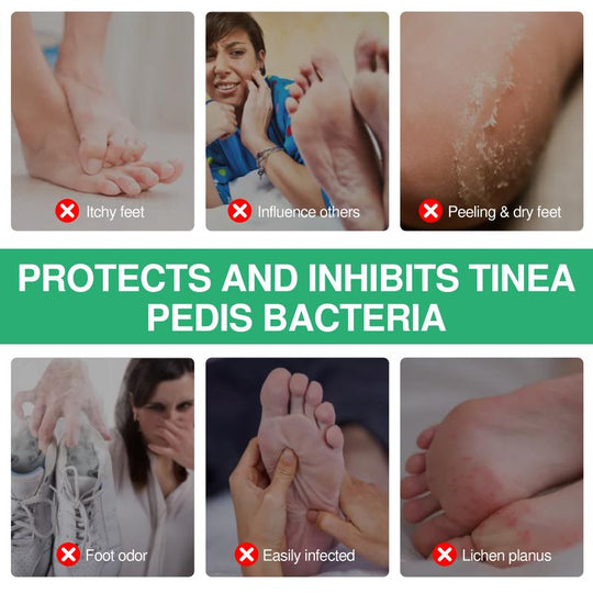 Herbal Antibacterial Foot Spray with Tea Tree Oil - 100ml Long-Lasting Formula for Foot Odor, Athlete's Foot Treatment & Fast-Acting Itch Relief