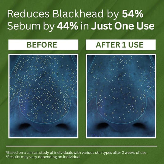 Holy Basil Bubble Deep Cleansing Mask