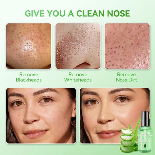 LANBENA Green Tea Blackhead Remover 100 sheet Nose Pore Strips & Pore Minimizer Serum Peel Off Mask for Pores, Nose, Chins & Face