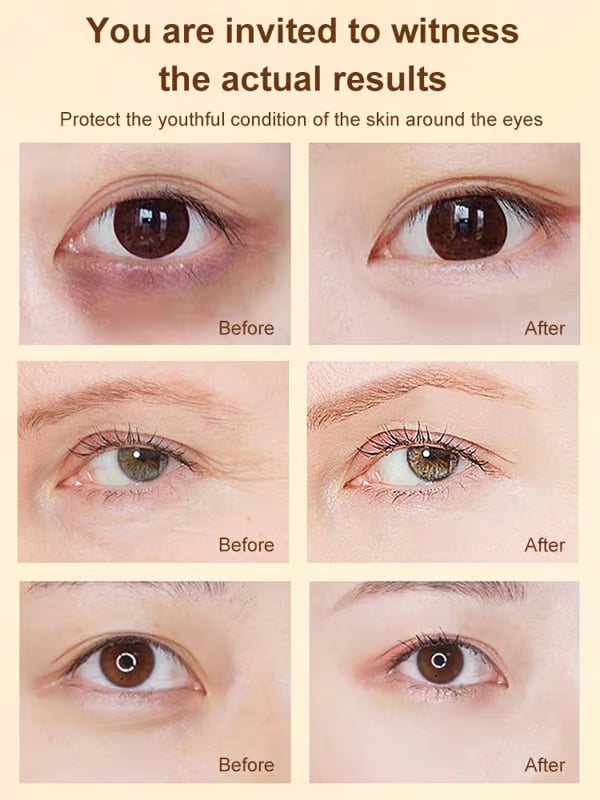 🔥LAST DAY 49% OFF✨ Lutein Eye Essence Oil✨