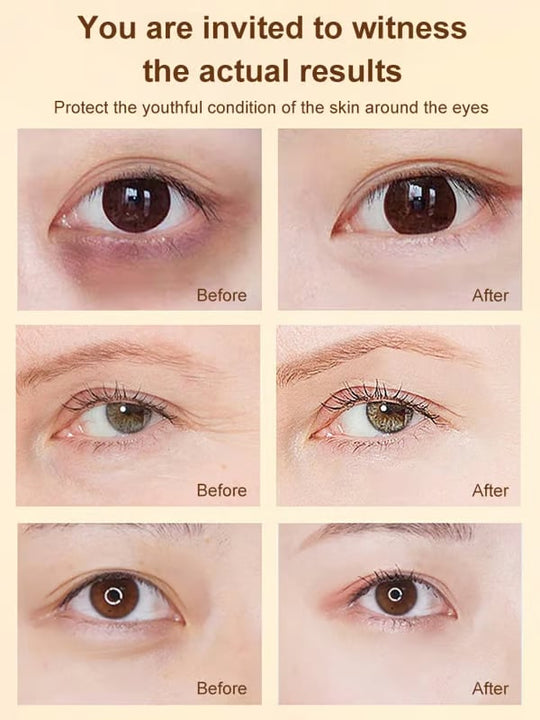 🔥LAST DAY 49% OFF✨ Lutein Eye Essence Oil✨