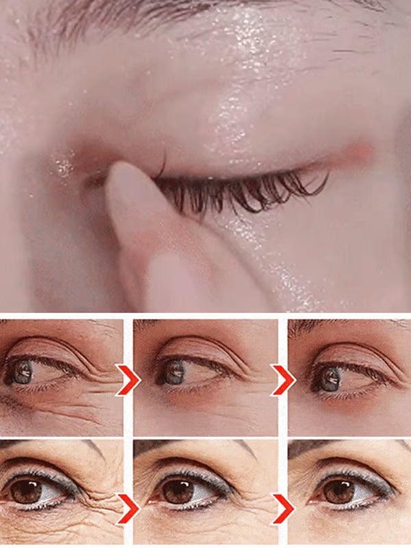 🔥LAST DAY 49% OFF✨ Lutein Eye Essence Oil✨