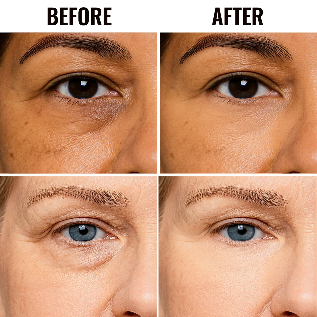 ✨ PROMOÇÃO DO ÚLTIMO DIA - COMPRE 1 E LEVE OUTRO GRÁTIS✨Corretivo para a área dos olhos, ideal para iluminar e disfarçar imperfeições. & Clarear olheiras