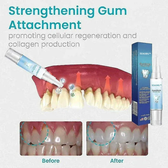 SEAGRIL™🔥Tandherstelgel verwijdert tandsteen, reinigt grondig en verlicht tandvleespijn.