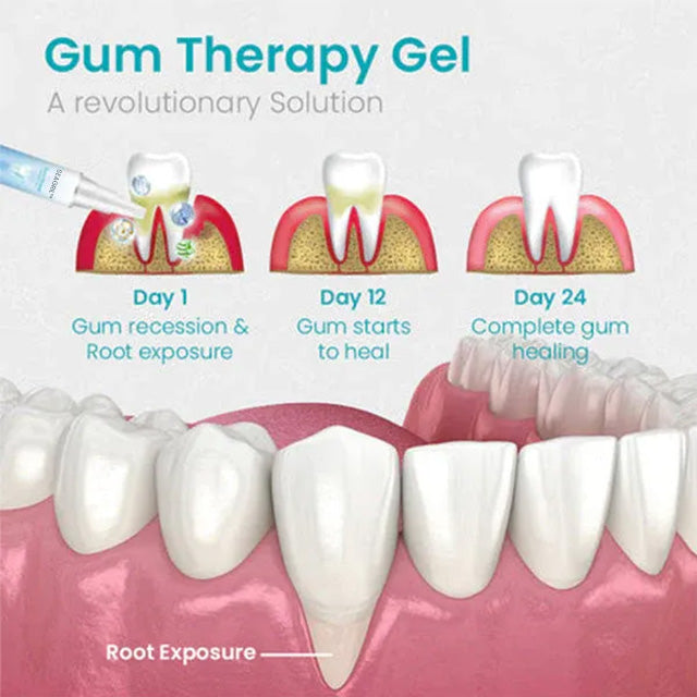 SEAGRIL™🔥Tandherstelgel verwijdert tandsteen, reinigt grondig en verlicht tandvleespijn.