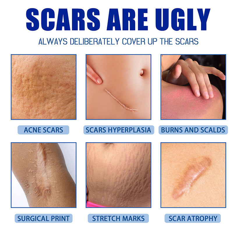 Scar Repair Cream for Men and Women, fade scars and tighten skin in one step
