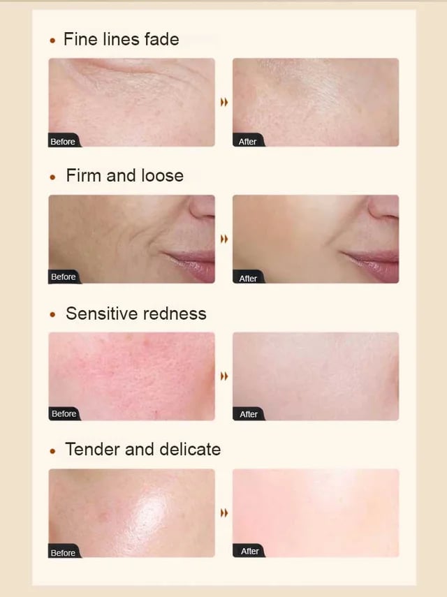 [Contra creșterii pielii] Esență antirid cu colagen💦