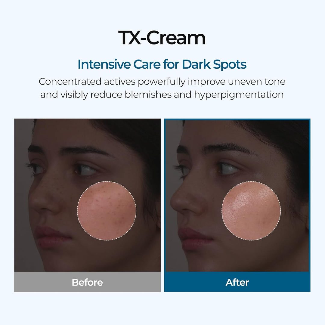 🧴 Crema all'acido tranexamico TX
