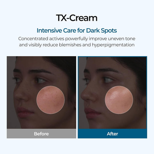 🧴 Crema all'acido tranexamico TX