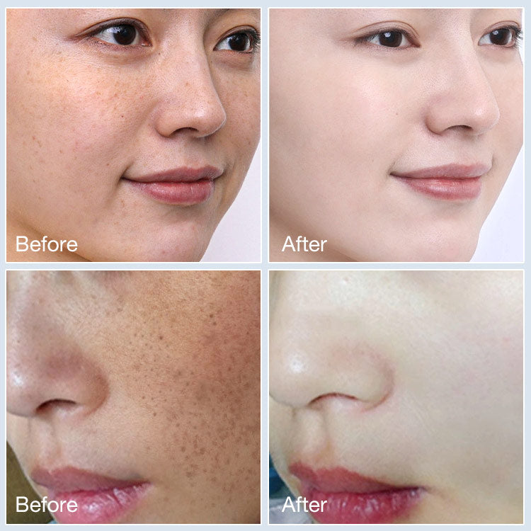 Traneksāmskābes krēms