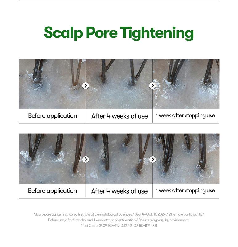 [VT Cosmetics] PDRN Reedle Shot Hair Ampoule 100dl 15ml | Creșterea părului ser fiole pentru tratamentul căderii părului