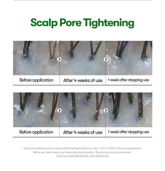 [VT Cosmetics] PDRN Reedle Shot Hair Ampoule 100dl 15ml | Creșterea părului ser fiole pentru tratamentul căderii părului