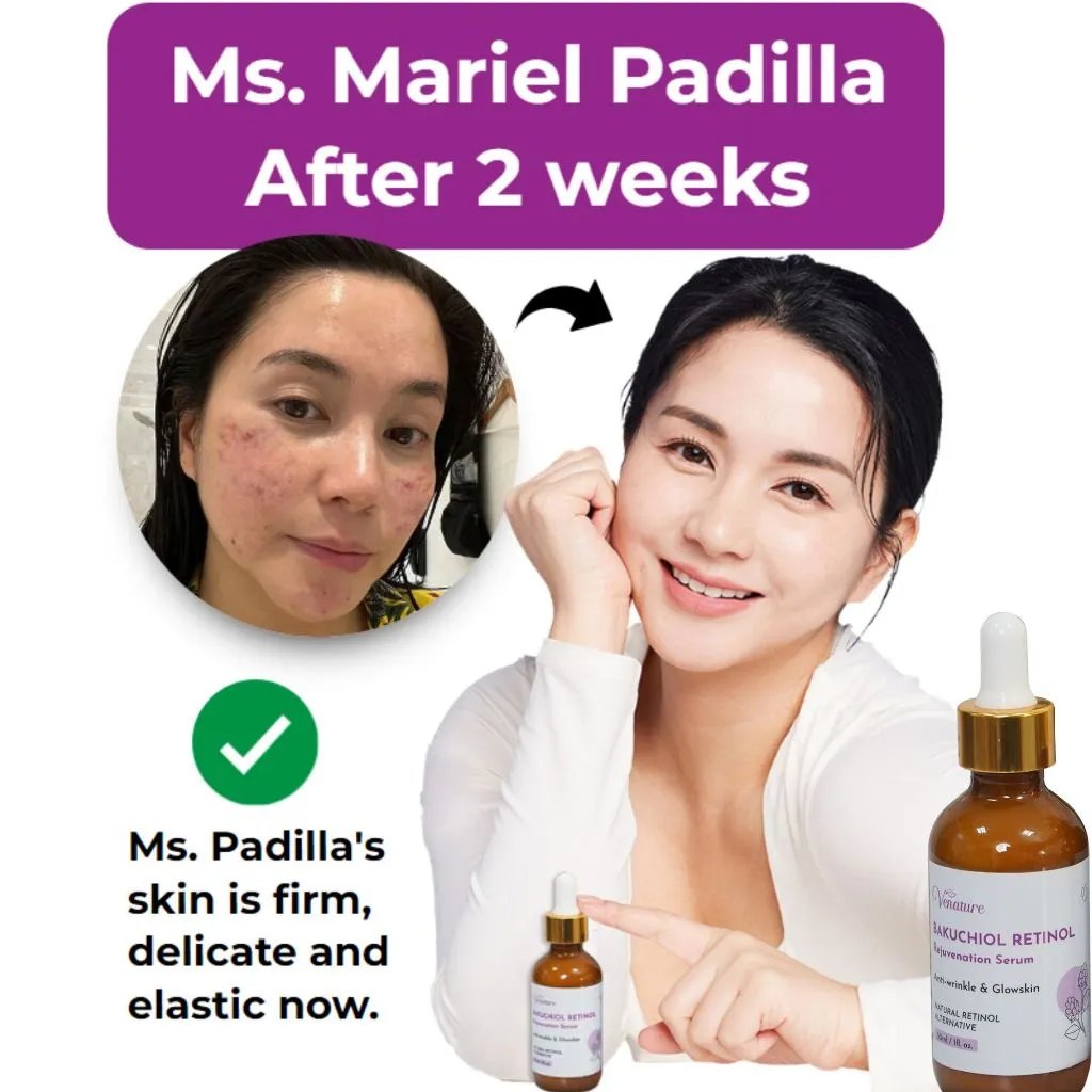 Ser de întinerire cu retinol Venature Bakuchiol