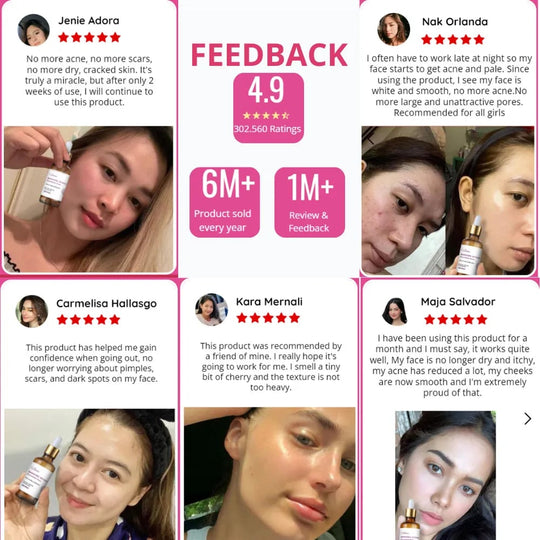 Ser de întinerire cu retinol Venature Bakuchiol