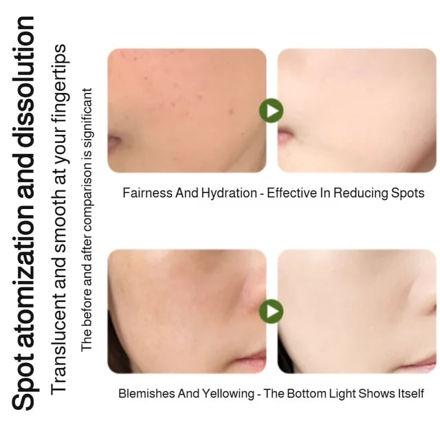 Spray de albire hidratanta esenta